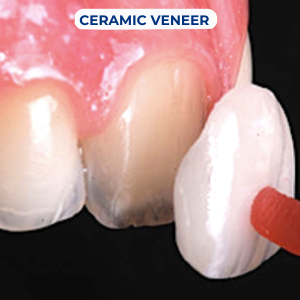 cosmetic dentistry